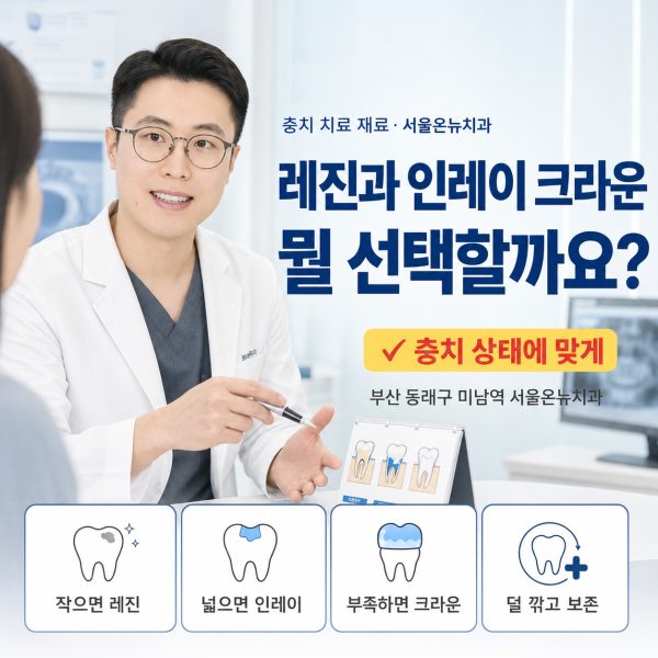 충치 치료 재료, 레진과 인레이 크라운 중 뭘 선택할까요? - 서울온뉴치과 원장 칼럼