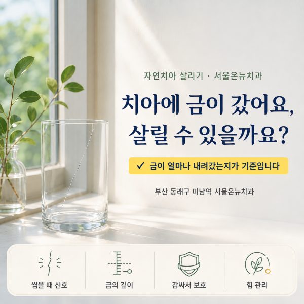치아에 금이 갔어요, 살릴 수 있을까요? 크라운과 발치를 결정하는 기준 - 서울온뉴치과 원장 칼럼