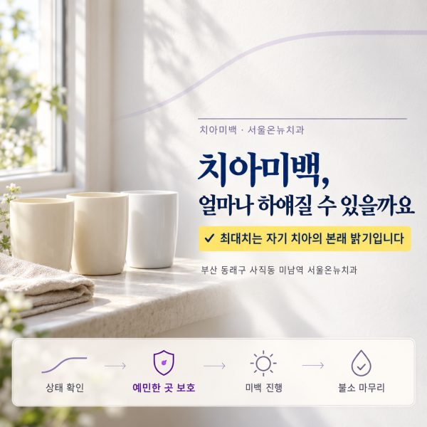 치아미백, 얼마나 하얘질 수 있나요? 효과가 잘 나는 치아와 아닌 치아 - 서울온뉴치과 원장 칼럼