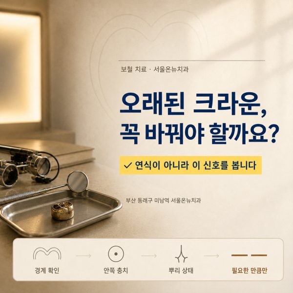 오래된 크라운 교체 시기, 몇 년 썼느냐보다 이 신호를 봅니다 - 서울온뉴치과 원장 칼럼