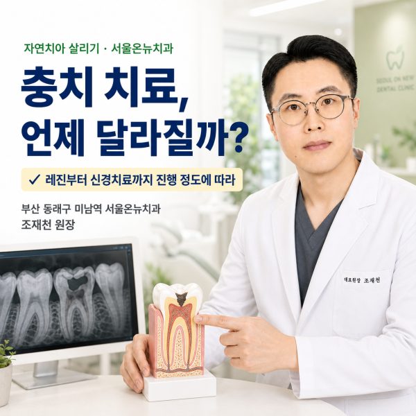 충치 치료, 레진부터 신경치료까지 언제 달라질까? - 서울온뉴치과 원장 칼럼